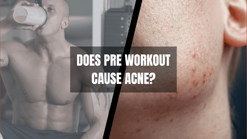 Read more about the article Does Pre Workout Cause Acne? – A Closer Look
